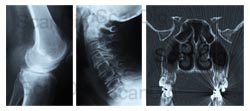 Röntgenbilder, Kernspintomographiebilder